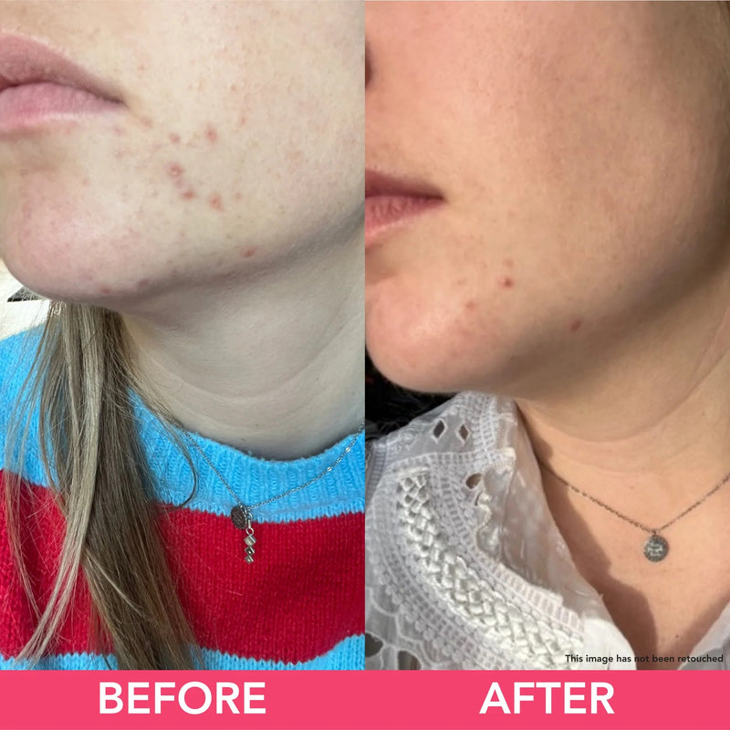 Teaology Tea Glow Exfoliating Cleansing Foam | Oczyszczająca pianka do twarzy